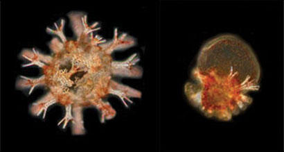A 5-day-old sea urchin reared in today's ocean conditions compared to one reared in high temperature and low pH